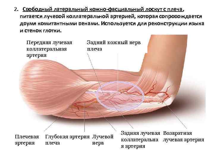 2. Свободный латеральный кожно-фасциальный лоскут с плеча,  питается лучевой коллатеральной артерией, которая сопровождается