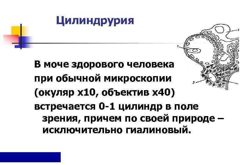 Цилиндрурия в моче. Цилиндрурия наблюдается при. Цилиндрурия 3-5 цилиндров в поле зрения наблюдается при. Причины цилиндрурии.