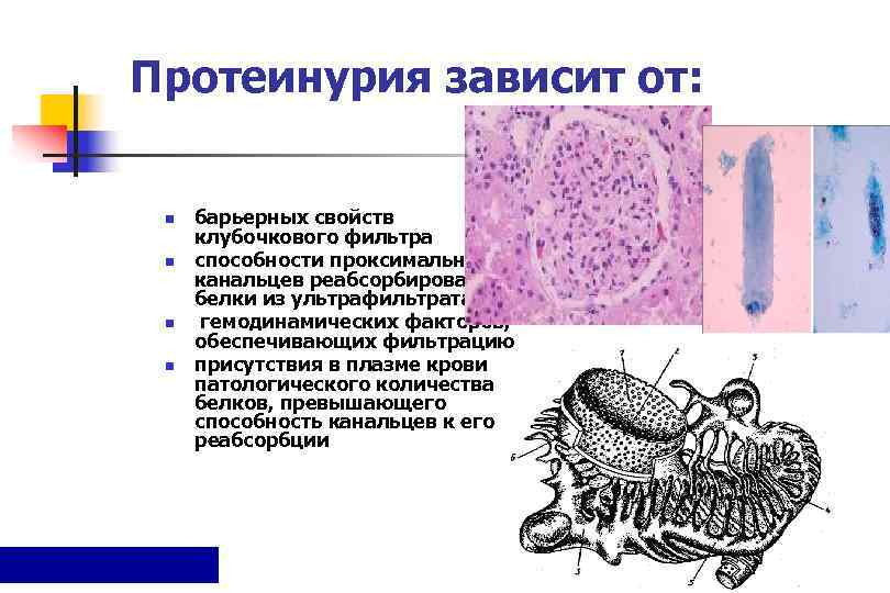 Протеинурия зависит от: n  барьерных свойств  клубочкового фильтра n  способности проксимальных