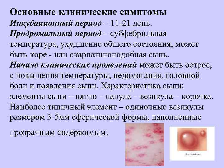 Основные клинические симптомы Инкубационный период – 11 21 день. Продромальный период – субфебрильная температура,