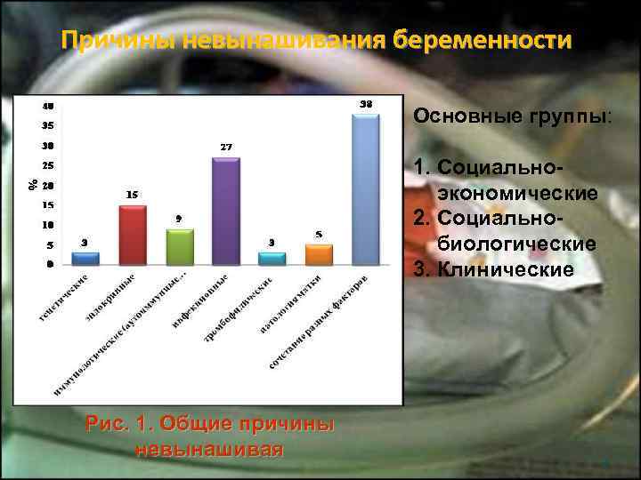 Причины невынашивания беременности      Основные группы:    