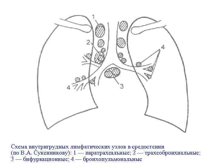 Схема внутригрудных лимфатических узлов в средостении (по В. А. Сукенникову): 1 — паратрахеальные; 2