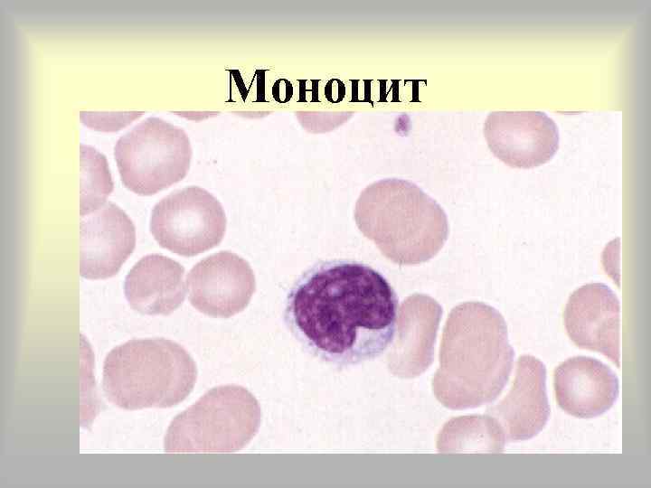 Картинки моноциты под микроскопом