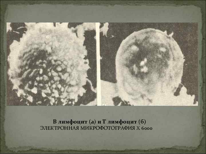   В лимфоцит (а) и Т лимфоцит (б) ЭЛЕКТРОННАЯ МИКРОФОТОГРАФИЯ X 6000 