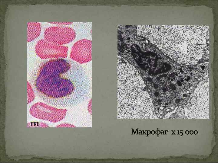 Макрофаг х 15 000 