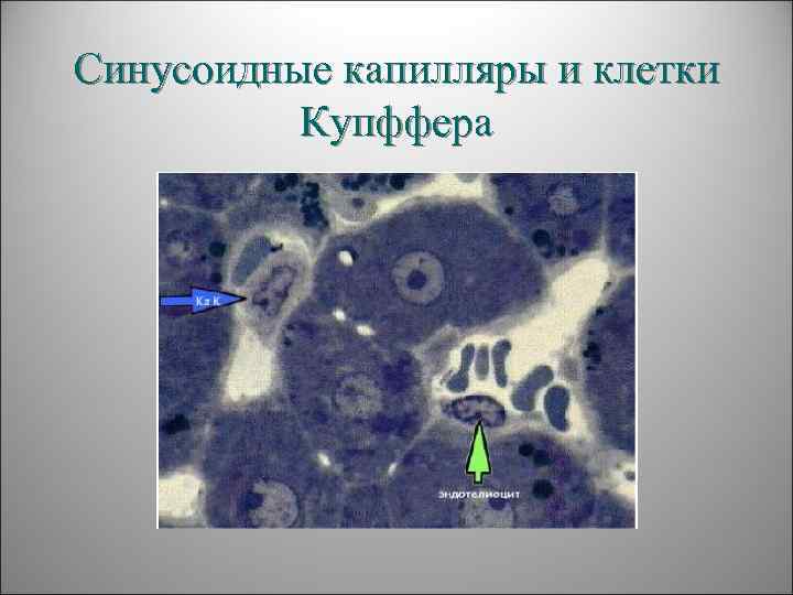 Синусоидные капилляры и клетки  Купффера 