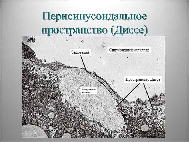 Перисинусоидальное пространство (Диссе) 
