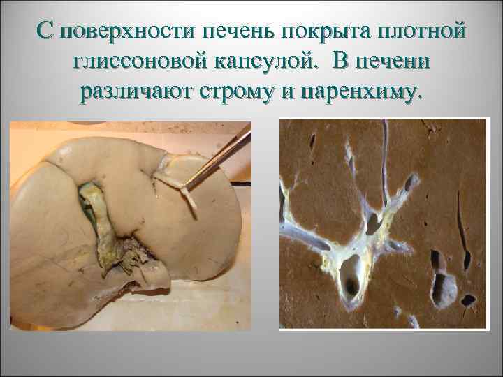 С поверхности печень покрыта плотной  глиссоновой капсулой. В печени различают строму и паренхиму.