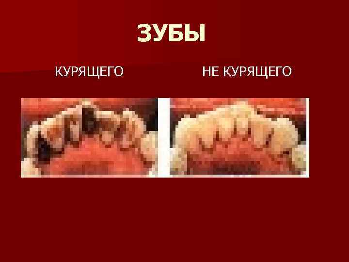   ЗУБЫ КУРЯЩЕГО НЕ КУРЯЩЕГО 