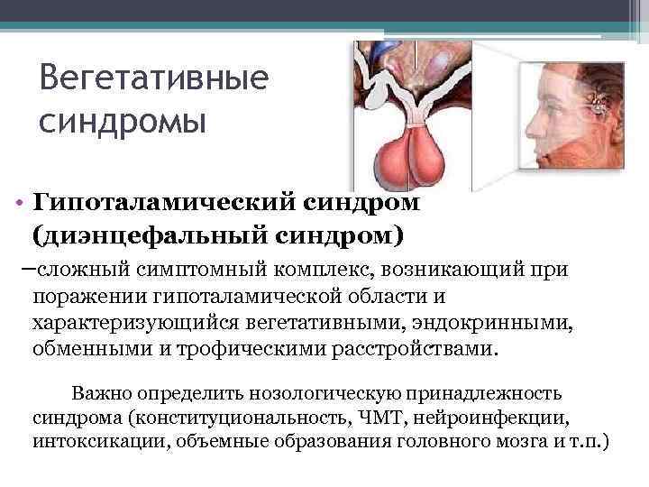  Вегетативные  синдромы  • Гипоталамический синдром  (диэнцефальный синдром) –сложный симптомный комплекс,