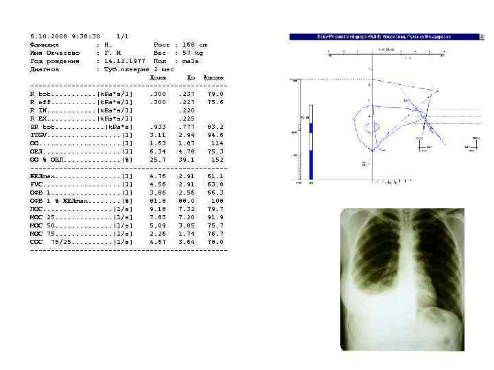 6. 10. 2008 9: 38: 30 Фамилия : Имя Отчество : Год рождения :
