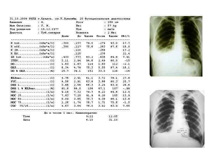 31. 10. 2008 РКПД Фамилия Имя Отчество Год рождения Диагноз г. Казань, ул. П.