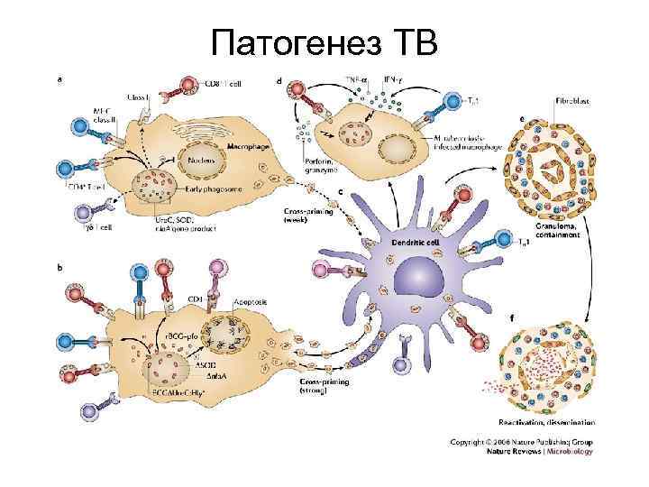 Патогенез TB 