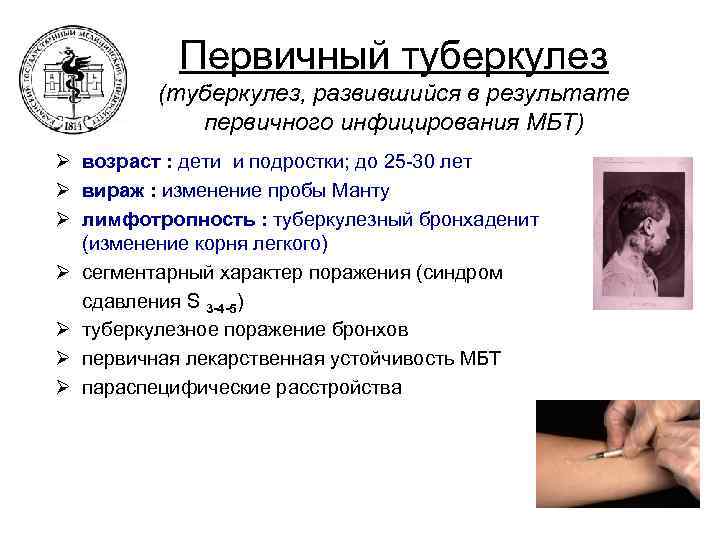 Первичный туберкулез (туберкулез, развившийся в результате первичного инфицирования МБТ) Ø возраст : дети и