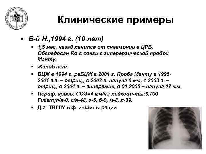 Клинические примеры § Б-й Н. , 1994 г. (10 лет) § 1, 5 мес.