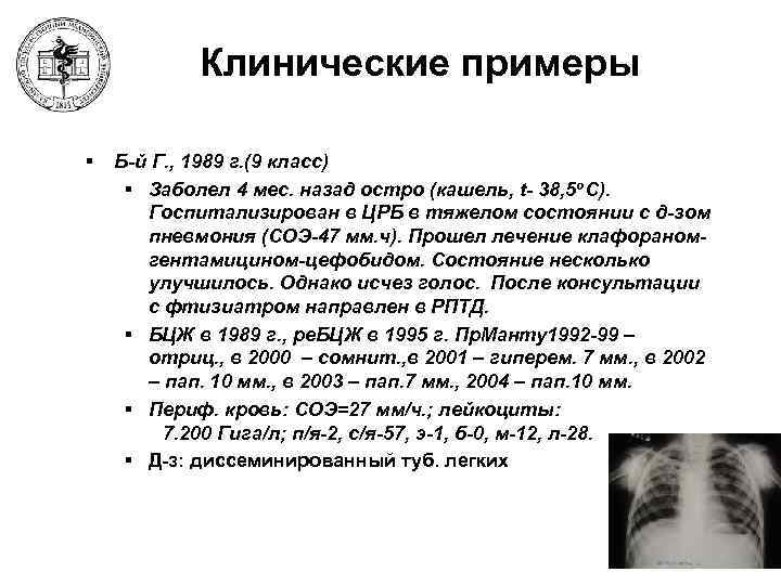 Клинические примеры § Б-й Г. , 1989 г. (9 класс) § Заболел 4 мес.