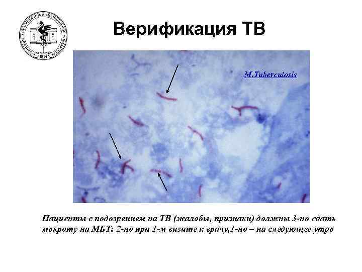Верификация ТВ M. Tuberculosis Пациенты с подозрением на ТВ (жалобы, признаки) должны 3 -но