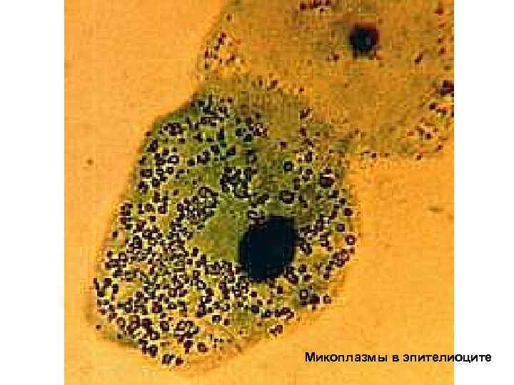 Микоплазмы в эпителиоците 