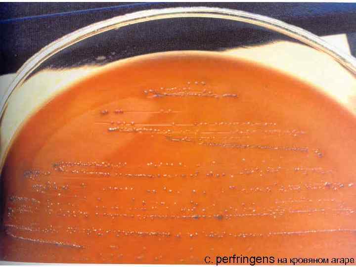 C. perfringens на кровяном агаре 