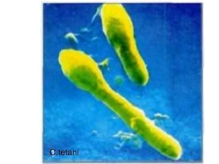 C. tetani 
