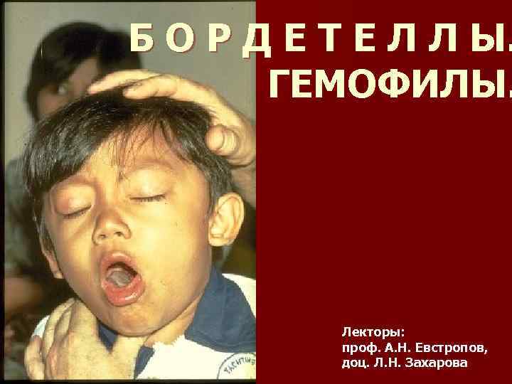 Б О Р Д Е Т Е Л Л Ы.   ГЕМОФИЛЫ. 