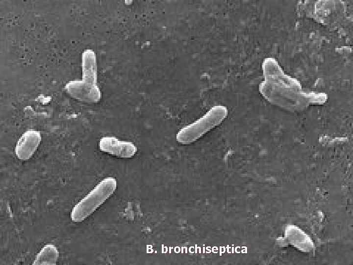 B. bronchiseptica 