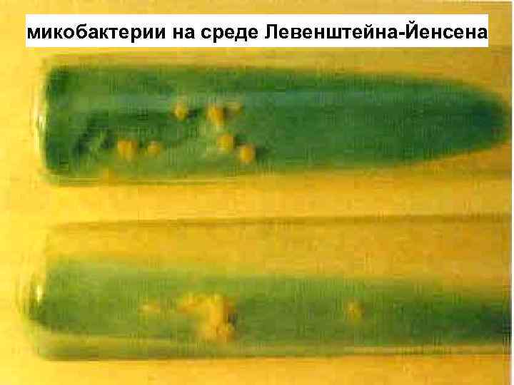 микобактерии на среде Левенштейна-Йенсена 