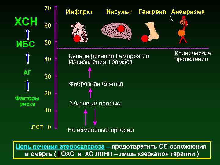 70 ХСН ИБС Инсульт Гангрена Аневризма 60 50 40 АГ Инфаркт Кальцификация Геморрагии Изъязвления