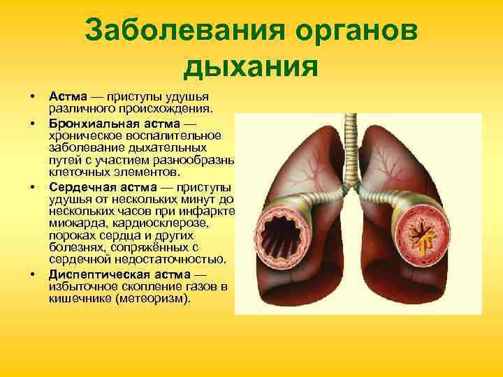 Презентация по биологии 8 класс болезни органов дыхания и их предупреждение гигиена дыхания