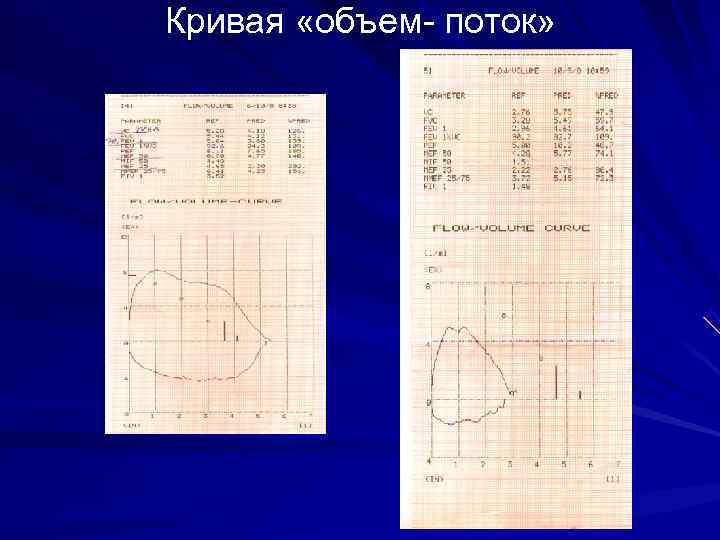 Кривая «объем- поток» 