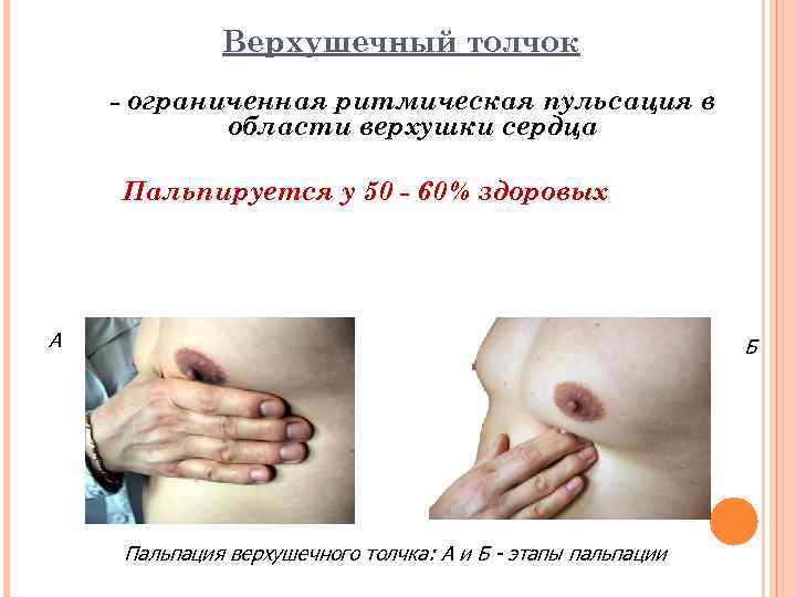    Верхушечный толчок - ограниченная ритмическая пульсация в   области верхушки