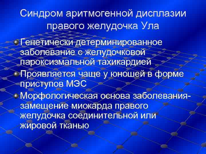 Синдром аритмогенной дисплазии правого желудочка Ула Генетически детерминированное заболевание с желудочковой пароксизмальной тахикардией Проявляется