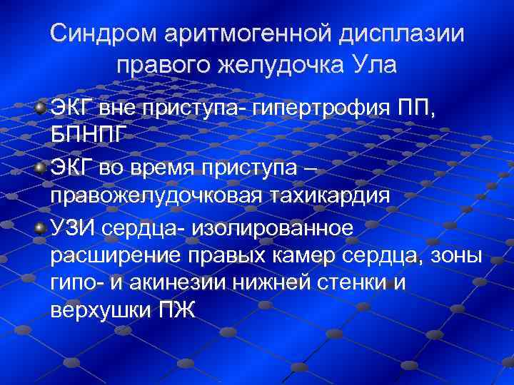 Синдром аритмогенной дисплазии правого желудочка Ула ЭКГ вне приступа- гипертрофия ПП,  БПНПГ ЭКГ