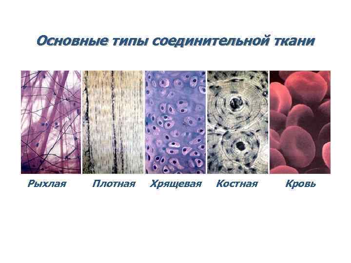 Основные типы соединительной ткани Рыхлая Плотная Хрящевая Костная Кровь Основные типы соединительной ткани Рыхлая Плотная Хрящевая Костная Кровь