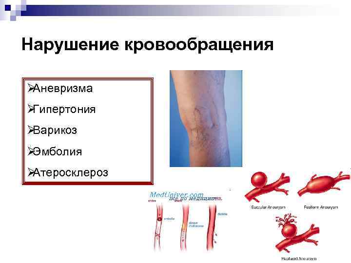 Нарушение кровообращения ØАневризма ØГипертония ØВарикоз ØЭмболия ØАтеросклероз 