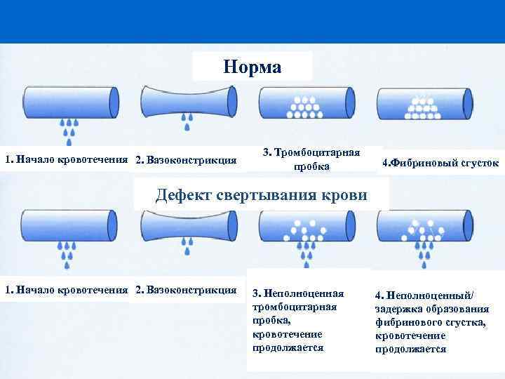       Норма     3. Тромбоцитарная