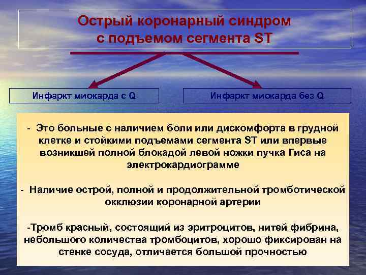    Острый коронарный синдром   с подъемом сегмента ST Инфаркт миокарда