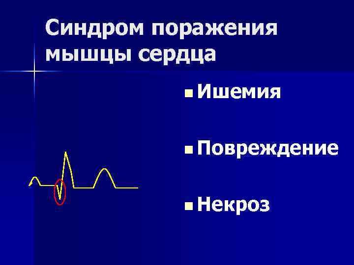 Синдром поражения мышцы сердца  n Ишемия   n Повреждение   n