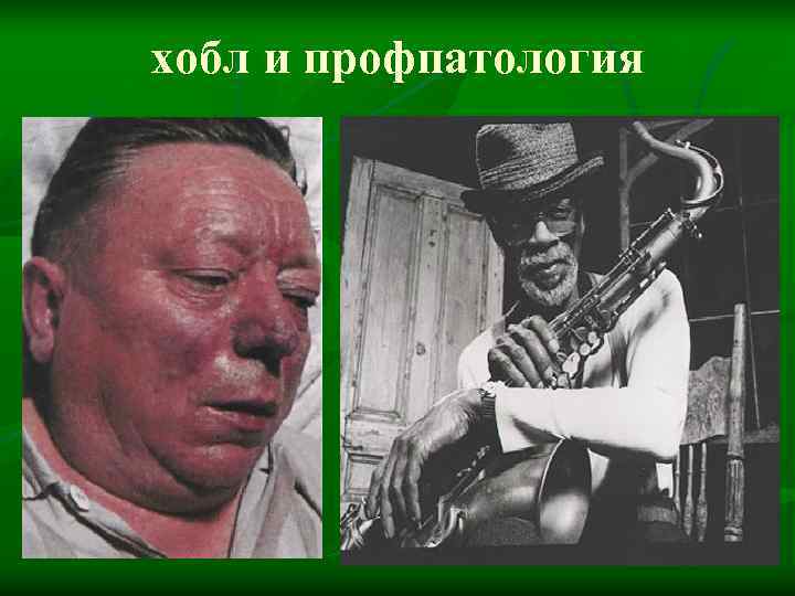 хобл и профпатология 
