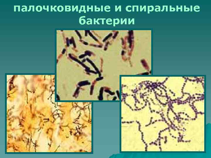 палочковидные и спиральные   бактерии 