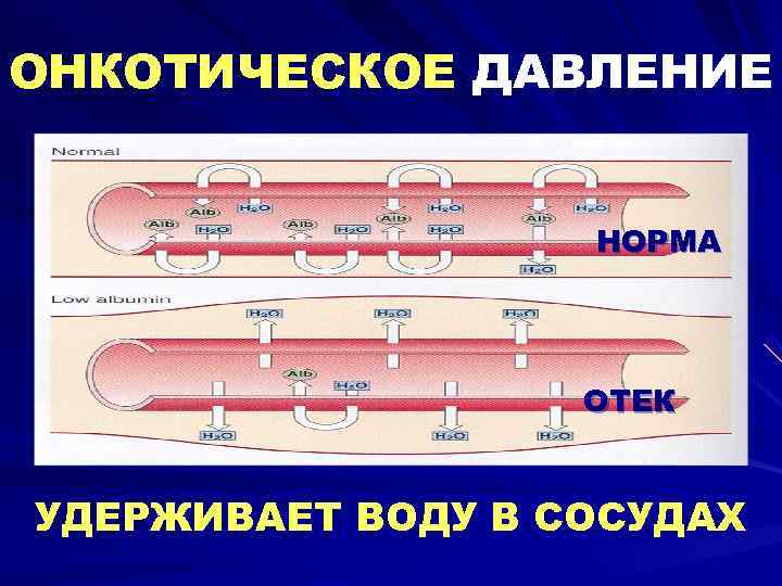 ОНКОТИЧЕСКОЕ ДАВЛЕНИЕ     НОРМА    ОТЕК  УДЕРЖИВАЕТ ВОДУ