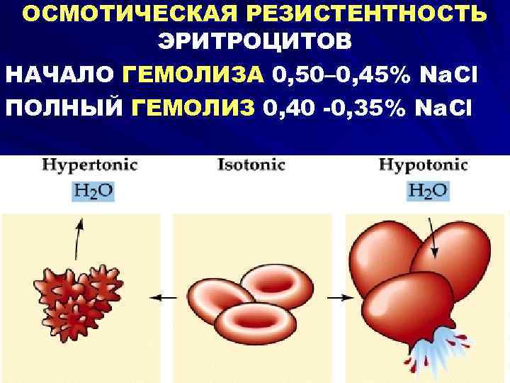  ОСМОТИЧЕСКАЯ РЕЗИСТЕНТНОСТЬ   ЭРИТРОЦИТОВ НАЧАЛО ГЕМОЛИЗА 0, 50– 0, 45% Na. Cl
