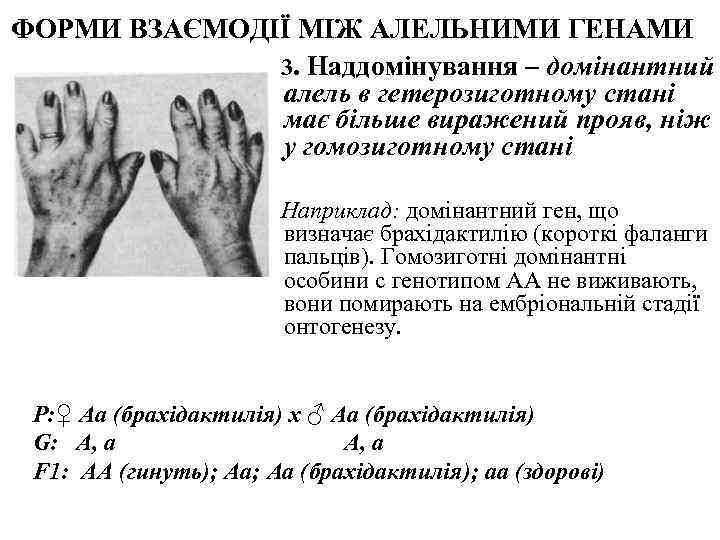 ФОРМИ ВЗАЄМОДІЇ МІЖ АЛЕЛЬНИМИ ГЕНАМИ    3. Наддомінування – домінантний  