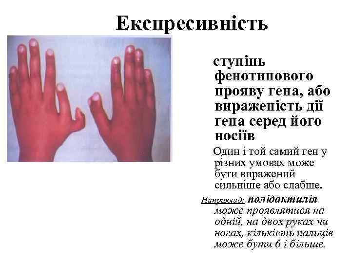 Експресивність   ступінь   фенотипового   прояву гена, або  