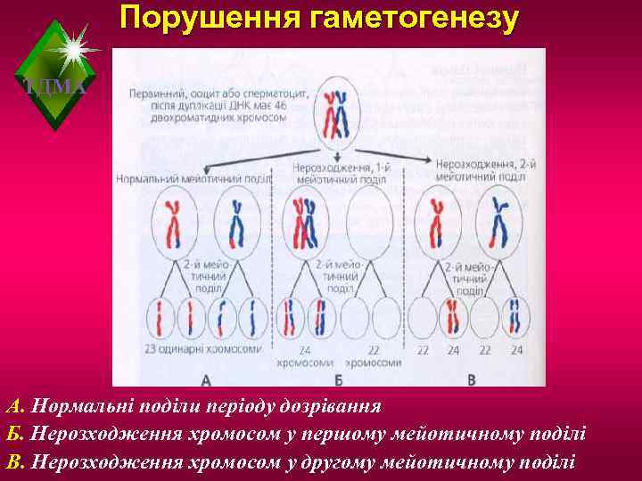    Порушення гаметогенезу  ТДМА А. Нормальні поділи періоду дозрівання Б. Нерозходження