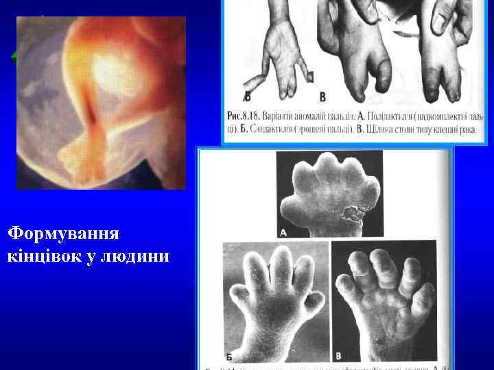 ТДМА Формування кінцівок у людини 