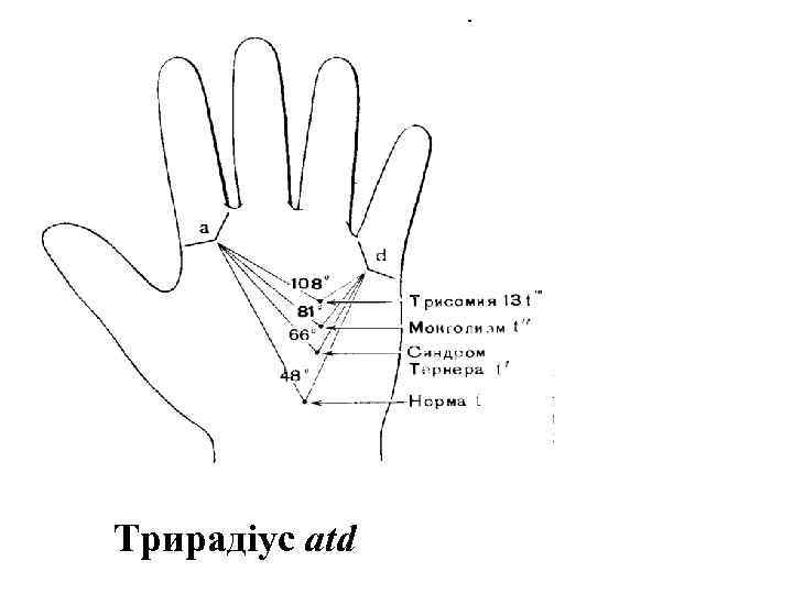 Трирадіус atd 