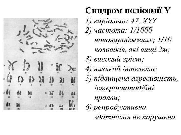 Синдром полісомії Y 1) каріотип: 47, XYY 2) частота: 1/1000  новонароджених; 1/10 