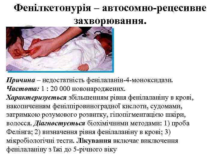  Фенілкетонурія – автосомно-рецесивне   захворювання. Причина – недостатність фенілаланін-4 -моноксидази. Частота: 1