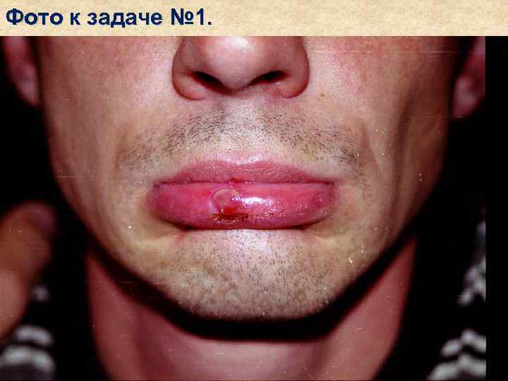 Фото к задаче № 1. 